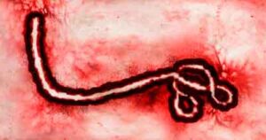 Ebola Virus